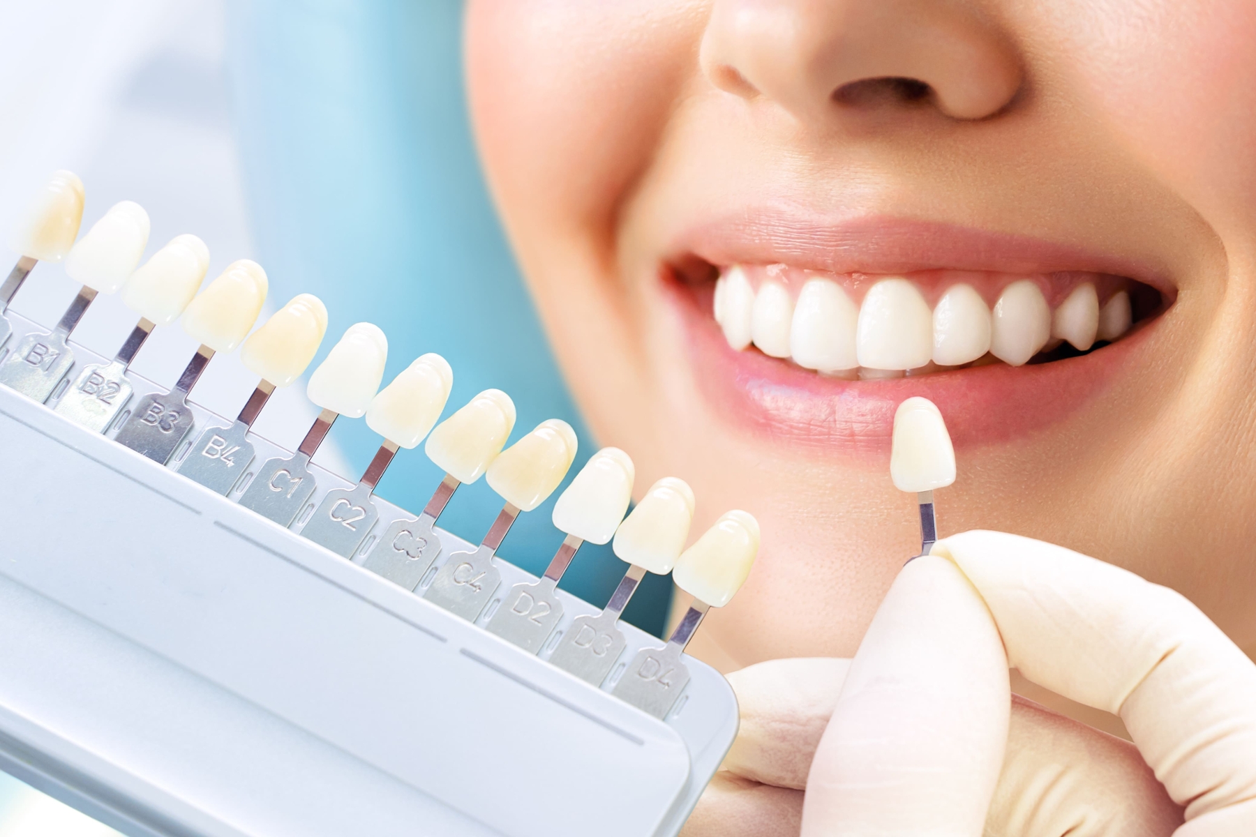 Teeth Whitening in Albany