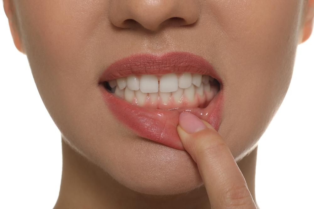 Gum Disease Albany 