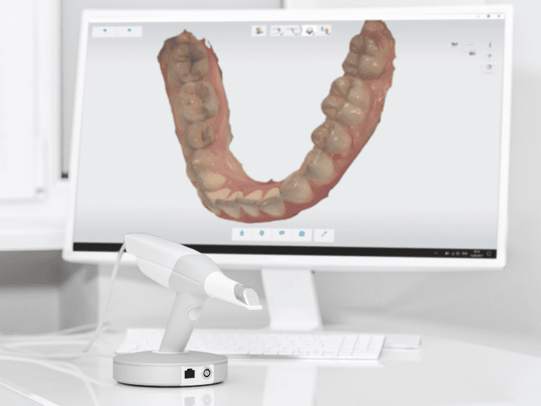 Dental Intraoral Scanners