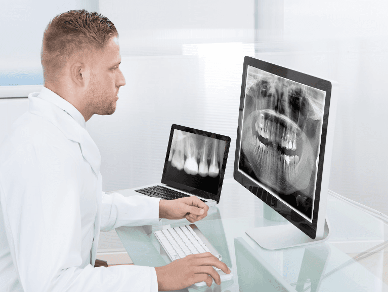 Dental CBCT 3D X-RAY